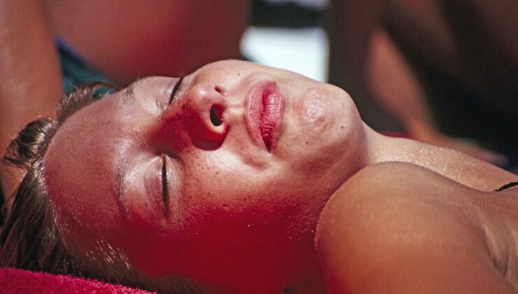 GÜNEŞ YANIĞINDAN HIZLICA KURTULUN Kırmızı ve kaşıntılı cildi rahatlatmak için ne yapılmalı!