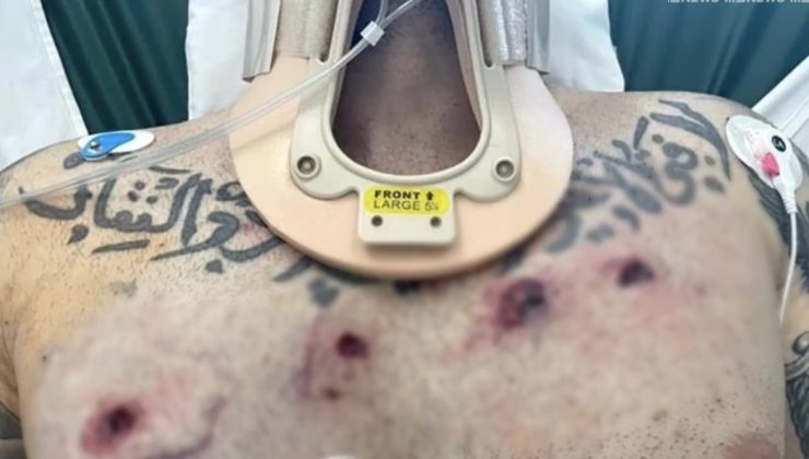 HASTANEDEN MESAJ VERDİ ‘Allah büyük’ – ‘Günlerini görecekler’