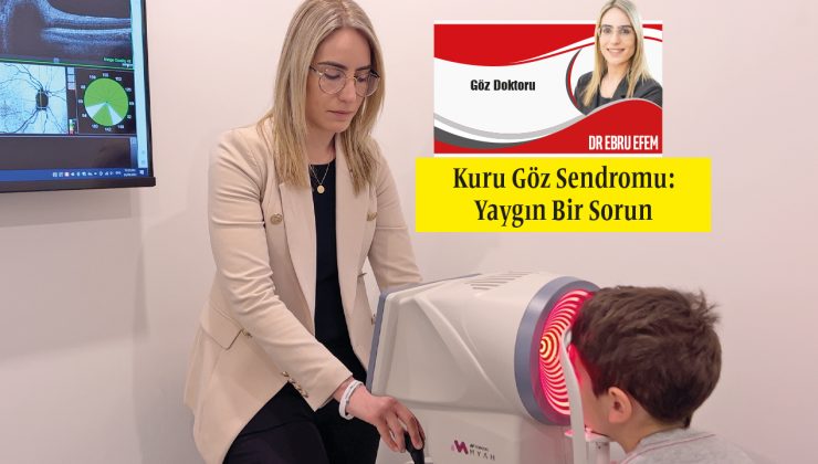 Kuru Göz Sendromu: Yaygın Bir Sorun