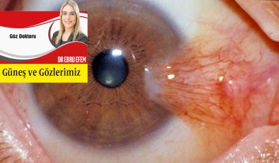 <strong>Güneş ve Gözlerimiz</strong>