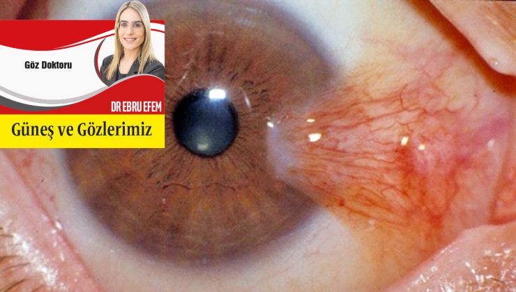 <strong>Güneş ve Gözlerimiz</strong>