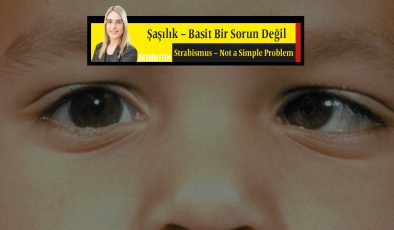 Şaşılık ‘Basit Bir Sorun Değil’ ENGLISH <strong>Strabismus – Not a Simple Problem  </strong>