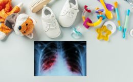 Sydney’deki Kreşte Verem (Tüberküloz) Alarmı