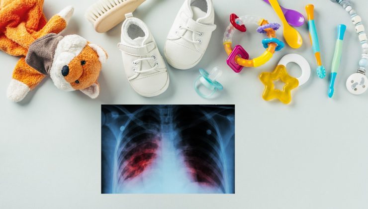 Sydney’deki Kreşte Verem (Tüberküloz) Alarmı